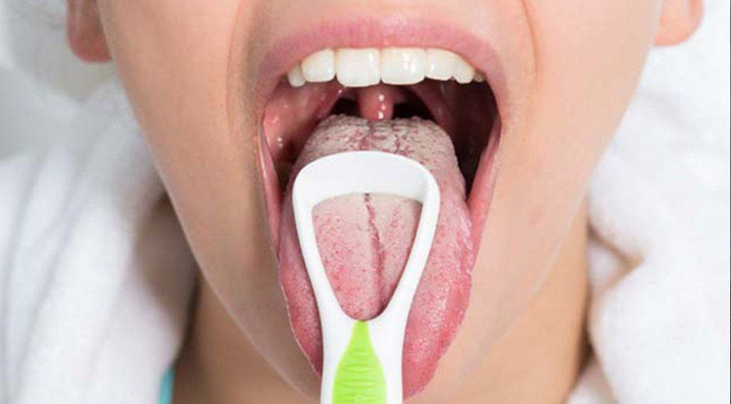 Dilde kabarcıklar neden olur? Nasıl geçer? - Resim: 3