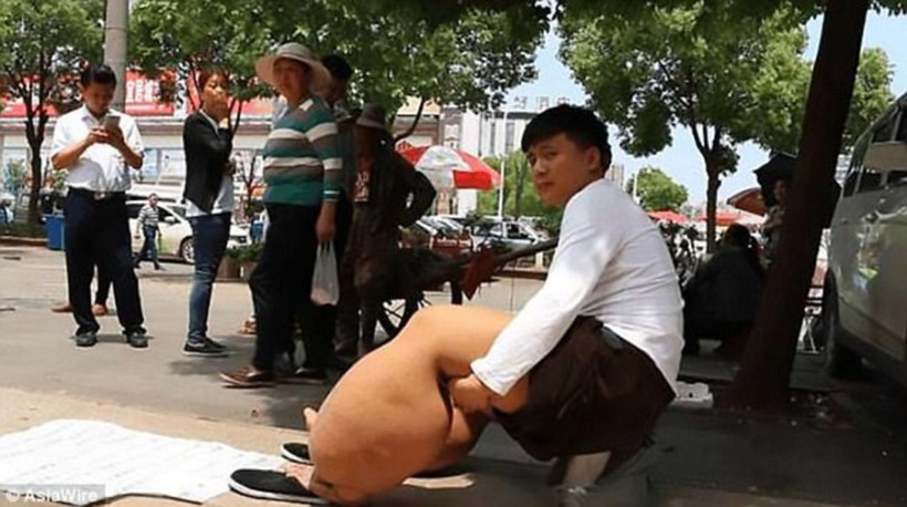 Sivrisinek ısırığı deyip geçmeyin bacağı öyle bir hale geldi ki... - Resim: 2