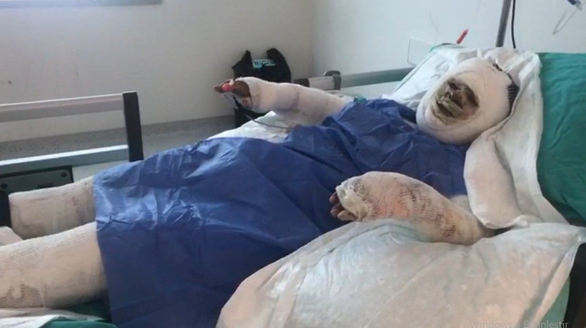 Mersin'de damat üzerine benzin döküp ateşe verdiği kayınvalidesinin alevler içinde yanmasını izledi - Resim: 1