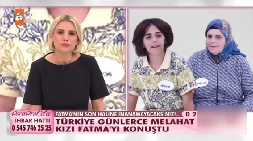 ATV Esra Erol'da zihinsel engelli Fatma'nın son hali yürek burktu! Saçlarını kazımışlar! - Resim: 3
