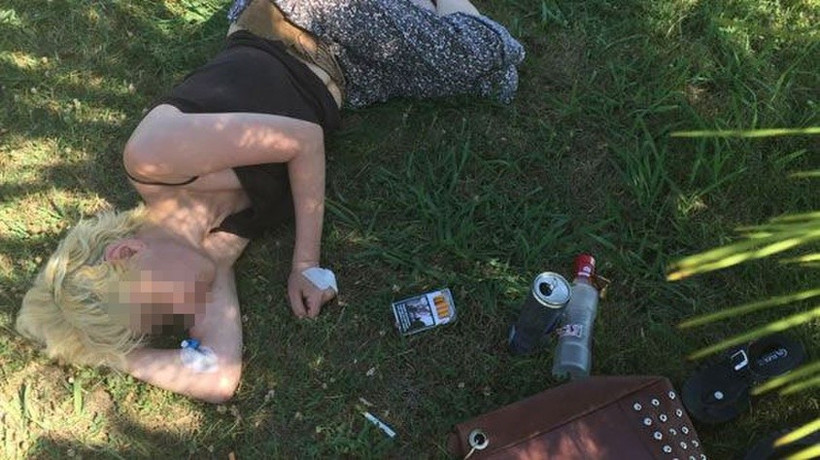 Genç kadının kullandığı şeyler onu bu hale getirdi... - Resim: 1