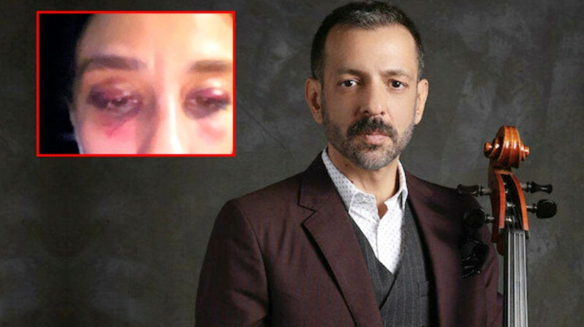 Rubato solisti Özer Arkun'un sevgilisi Burcu Yılmaz'a şiddet davasında yeni gelişme - Resim: 3