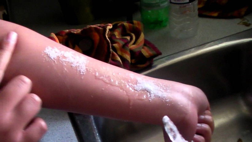 Bu nasıl akım! Vücutlarını delik deşik ediyorlar tuz ve buz... - Resim: 4