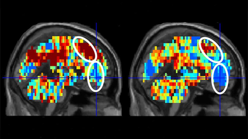 Yapay zeka intihar riskini ölçecek - Resim: 2