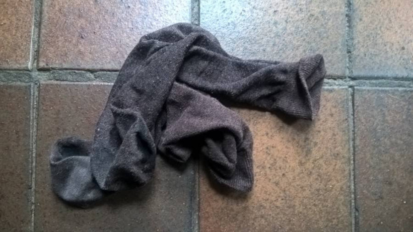 Çorap koklama bağımlısı adamın ciğerleri mantar bağladı - Resim: 2