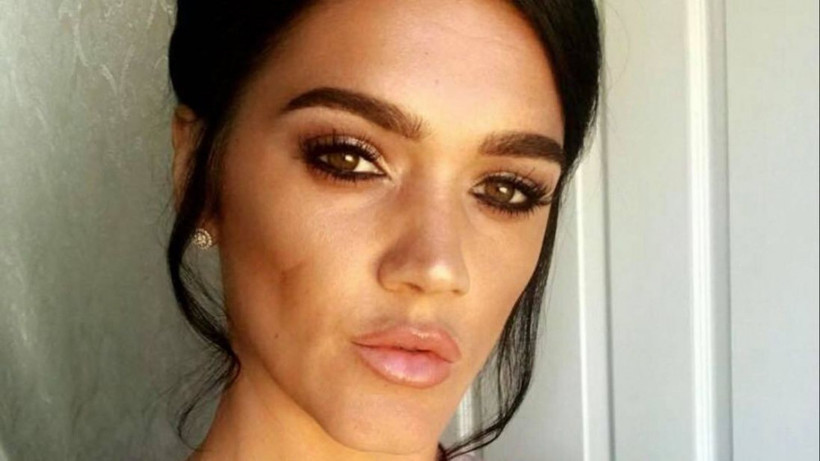 Türkiye'de kalça ameliyatı olan kadının ölüm nedeni belli oldu - Resim: 1