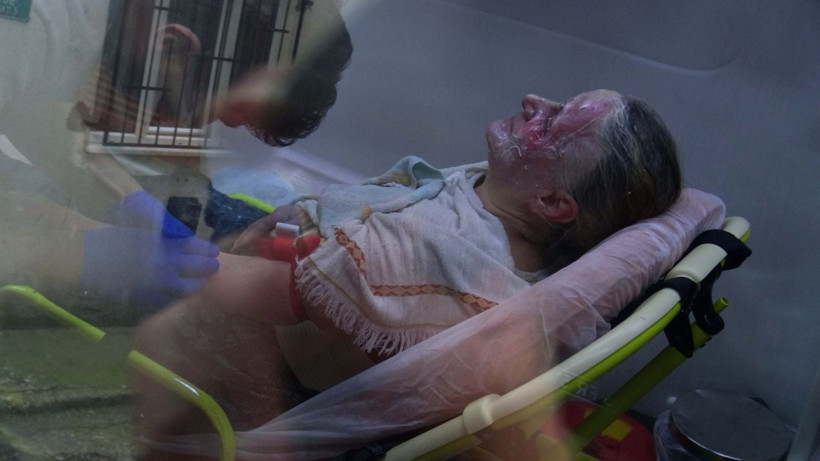 Bursa'da ispirto faciası! Kulak kıllarını temizlediği felçli eşini ve kendisini yaktı - Resim: 4