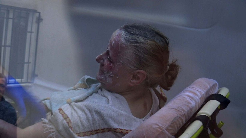 Bursa'da ispirto faciası! Kulak kıllarını temizlediği felçli eşini ve kendisini yaktı - Resim: 1