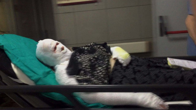 Bursa'da ispirto faciası! Kulak kıllarını temizlediği felçli eşini ve kendisini yaktı - Resim: 2