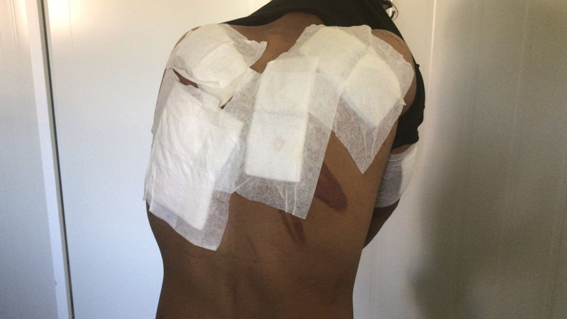 Plastik mermi elektrikli şok cihazları.... Dövüp Meriç Nehri'ne attılar! - Resim: 4