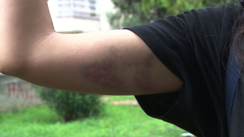 Kedileri besleyen öğretmenin başına gelmeyen kalmadı - Resim: 1