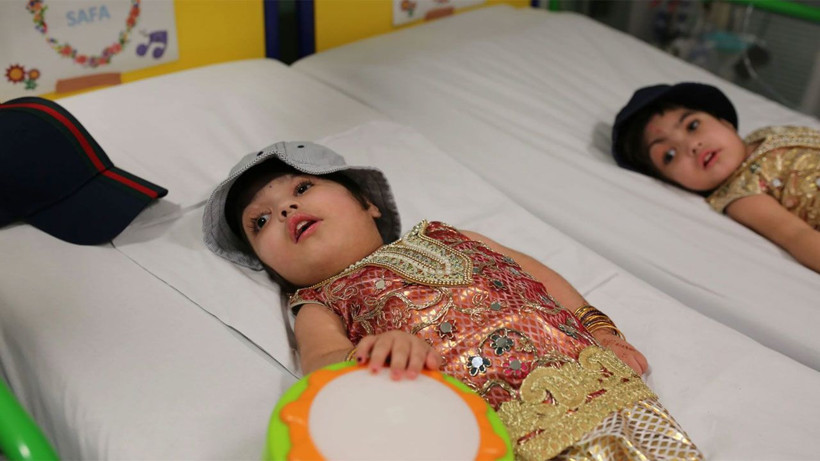 Dünya bu ameliyatı konuşuyor 100 doktor girdi 50 saatte yapışık ikizler birbirinden ayrıldı - Resim: 1