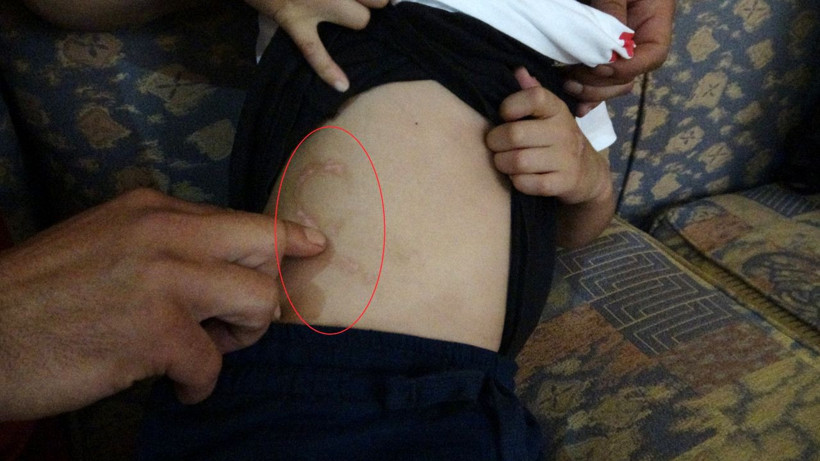 Eli matkapla delindi ısırıldı Van Gölü'ne atıldı! Mucize kurtuluşu anlattı - Resim: 4