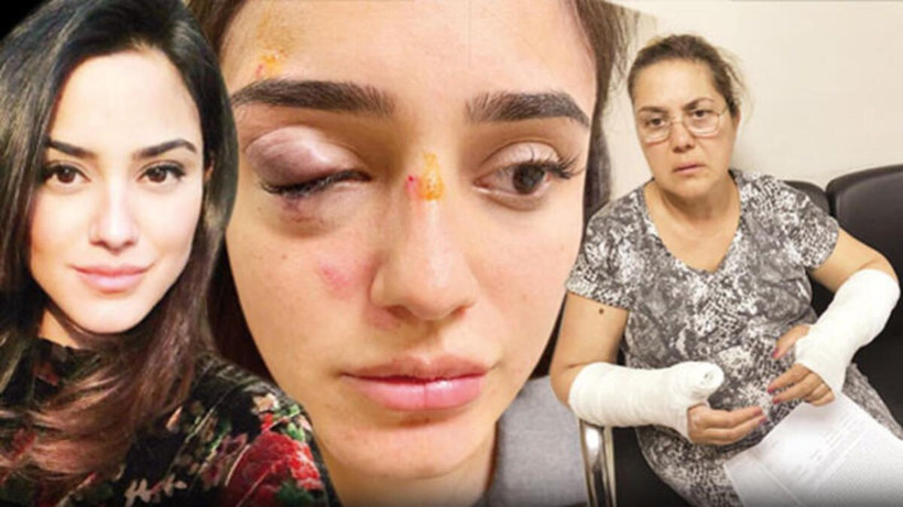 Rafet El Roman'ın eski eşi Ceren'in yüzü gözü patlamış! Baba Atilla Kaplakarslan tüm sırları ortaya döktü - Resim: 1