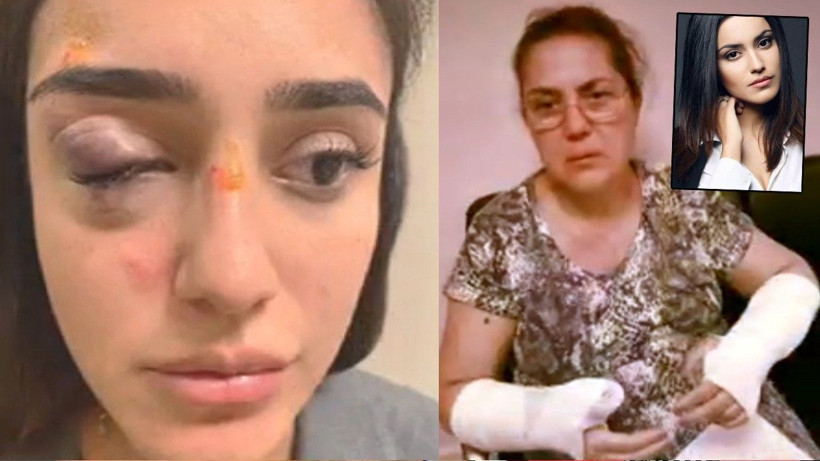 Rafet El Roman'ın eski eşi Ceren'in yüzü gözü patlamış! Baba Atilla Kaplakarslan tüm sırları ortaya döktü - Resim: 3