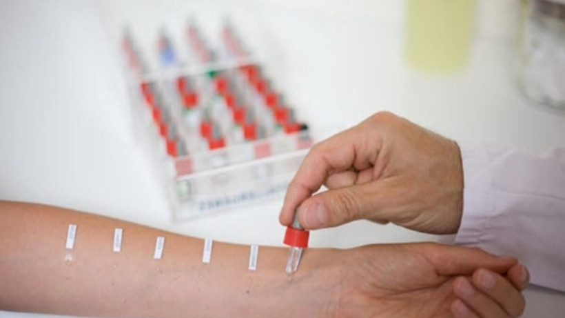 Türkiye'de erişkin alerji immünoloji hastalarının üçte biri bu merkezde hizmet alıyor - Resim: 4