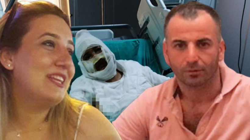 Eski eşini kızgın yağ ile yakmıştı! İşte istenen ceza - Resim: 2