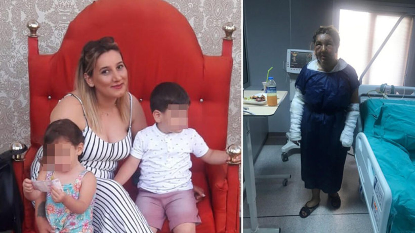 Eski eşini kızgın yağ ile yakmıştı! İşte istenen ceza - Resim: 3