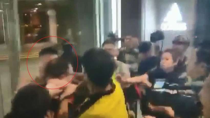 Hong Kong’da meclis üyesinin kulağı ısırılarak koparıldı - Resim: 2