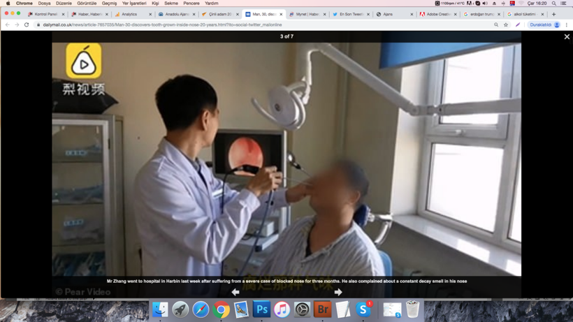 Solunum güçlüğü çektiği gerekçesiyle hastaneye gitti! Burnundan çıkan şoke etti - Resim: 3