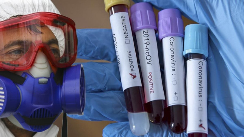 2020 felaketler yılı 80 günde başımıza gelmeyen kalmadı kıyamet mi kopacak - Resim: 2