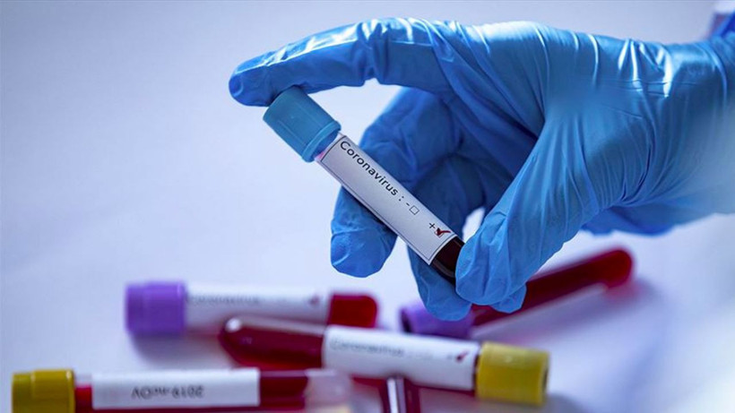 Ölen bir insandan ilk defa bir başkasına koronavirüs bulaştı! - Resim: 1