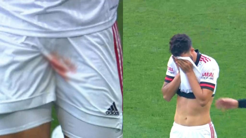 Futbol dünyası böyle sakatlık görmedi! Gözyaşlarıyla oyundan çıktı - Resim: 3