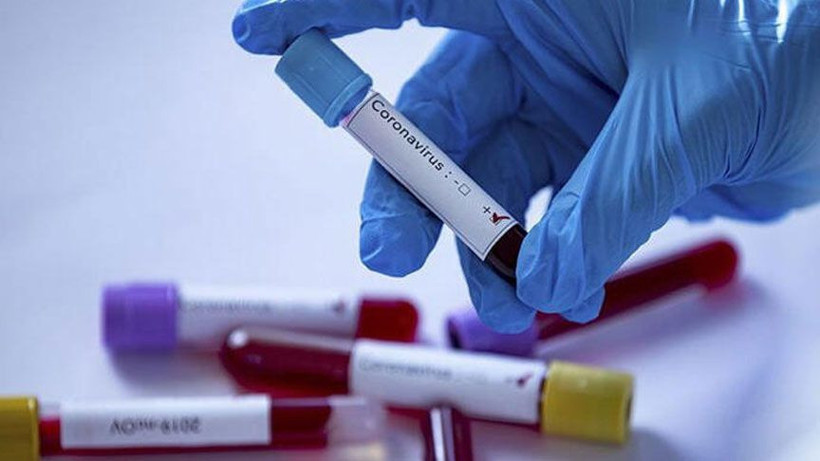 Koronavirüsün en gerçekçi görüntüsü ortaya çıktı! - Resim: 3