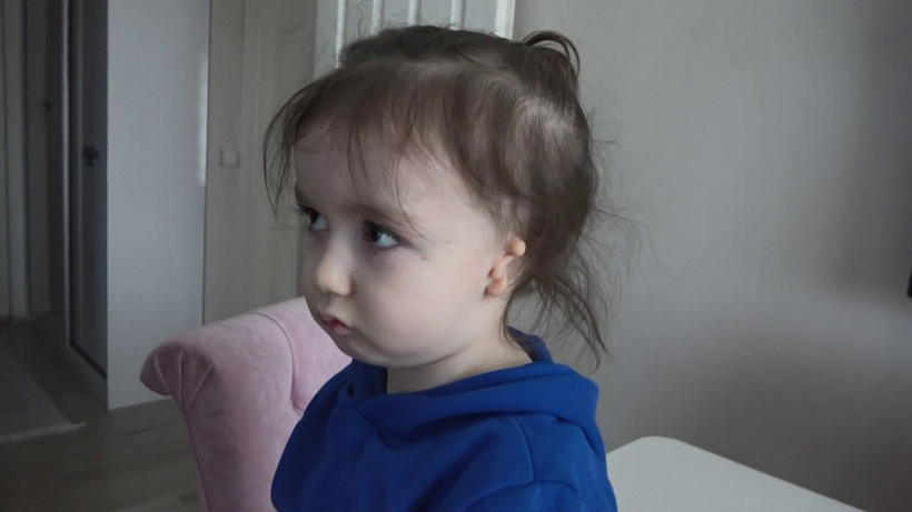 On binde bir görülüyor! Karabük'te minik Metin 'kulak yokluğu' yüzünden travma yaşayacak - Resim: 1