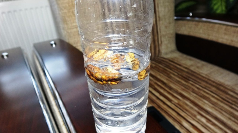 Bursa'da koronavirüs zannettiler gerçek başka çıktı! Akciğerinde ceviz tespit edildi - Resim: 2