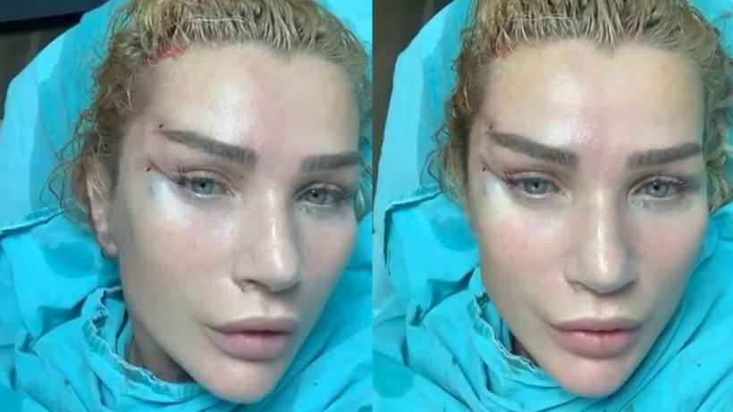 Estetikleri başını yaktı Seda Sayan'ı görenler 'Ne yaptın sen' diye sordu işte son hali - Resim: 3