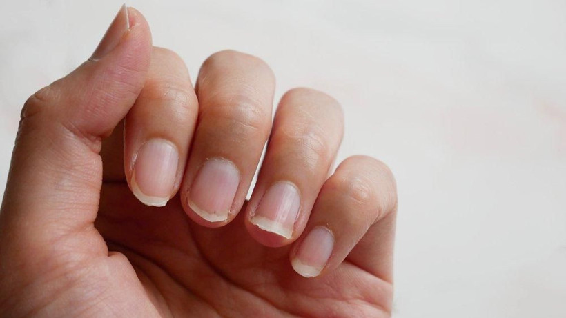 Demir eksikliği neden olur ne iyi gelir? - Resim: 2