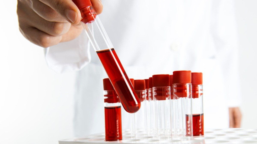 İdrardan kan gelmesi nedenleri ve tedavisi - Resim: 1