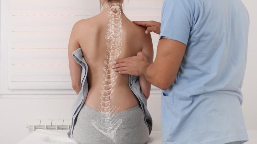 Skolyoz nedir skolyoz dereceleri tedavisi nasıl olur? - Resim: 4