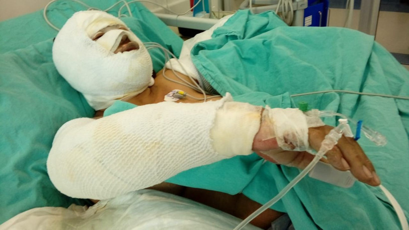 Mersin'de damat üzerine benzin döküp ateşe verdiği kayınvalidesinin alevler içinde yanmasını izledi - Resim: 2