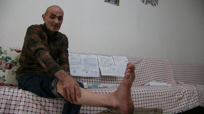 Artvin'de bel ağrısıyla gitti hayatının şokunu yaşadı: Bir anda yanmaya başladı - Resim: 4