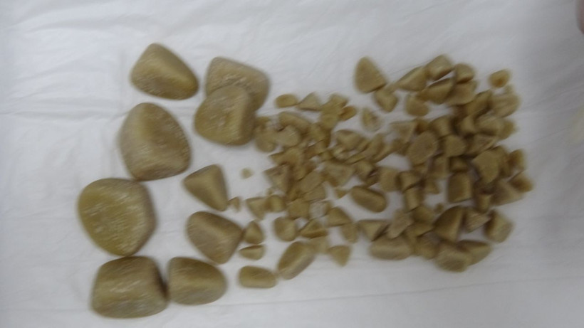 Zonguldak'ta golden cinsi köpeğin idrar kesesinden çıktı veteriner hekim inanamadı - Resim: 2