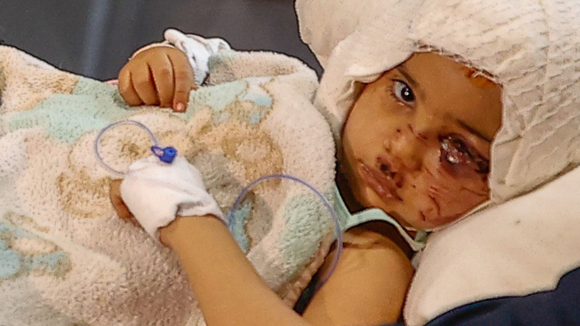 Gaziantep'te pitbull saldırısında yaralanan Asiye için Bakan Koca dünyaca ünlü o hekimimizi aradı - Resim: 3