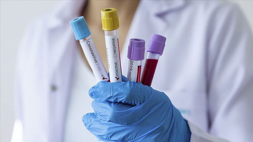 Covid 19 yine mutasyon geçirdi şimdi de Delmicron! Bu belirtilere dikkat edin - Resim: 1