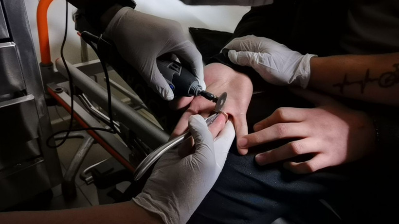 Bursa'da lise öğrencisi parmağına 1 lirayı taktı çıkaramadı - Resim: 2