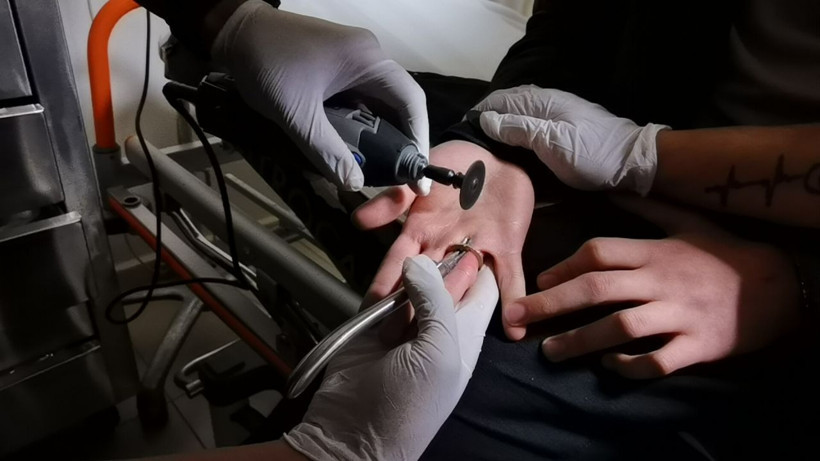 Bursa'da lise öğrencisi parmağına 1 lirayı taktı çıkaramadı - Resim: 4