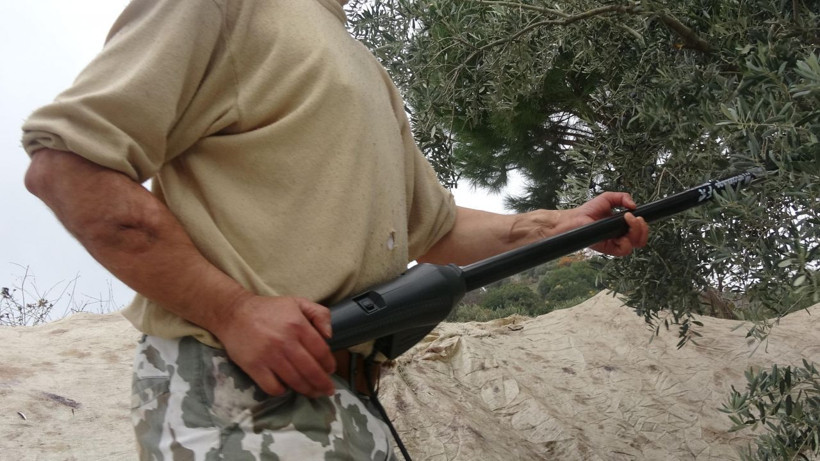 Kendi 39 kolları ise 12 yaşında! Aydınlı çiftçi tıp tarihine geçti - Resim: 3