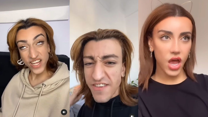 Instagram fenomeni Mika Can Raun estetik operasyon geçirdi Mika Raun kimdir işte son hali - Resim: 3