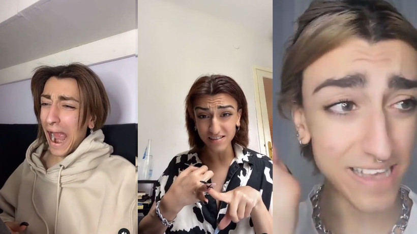 Instagram fenomeni Mika Can Raun estetik operasyon geçirdi Mika Raun kimdir işte son hali - Resim: 4