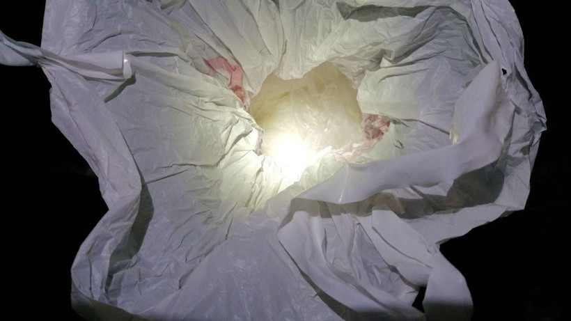 Yüz nakli yapılan Recep Sert gözaltına alındı - Resim: 2