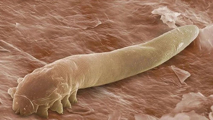 Demodex nedir? İnsan yüzünde milyonlarcası yaşıyor - Resim: 1