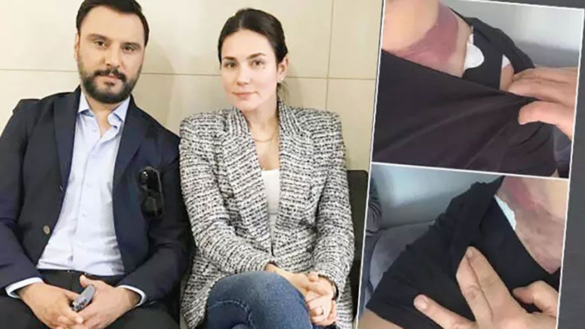 Ölümden dönen Alişan soluğu mahkemede aldı! Eşiyle davalık oldular - Resim: 3