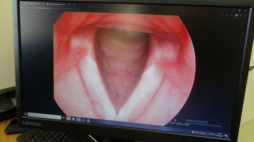 Ses kısıklığı yaşayanlar için uzman isimden önemli uyarı - Resim: 2