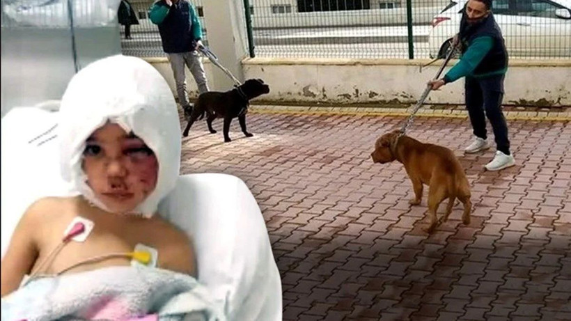 Pitbull saldırısında parçalanan Asiye'ye anne işkencesi! Şok fotoğraflar ortaya çıktı böyle bağlamış! - Resim: 1