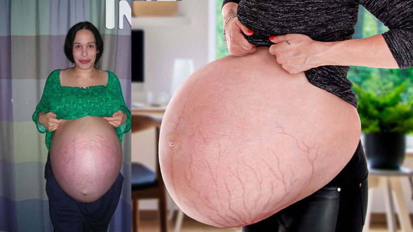 8 bebek doğurdu hepsi de birbirinden farklı babaları kim deniyordu anneye ahlaksız teklif - Resim: 1